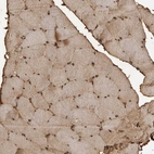 Immunohistochemical staining of human skeletal muscle shows strong nuclear-cytoplasmic positivity in myocytes.