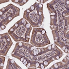 Immunohistochemical staining of human gastrointestinal shows moderate membranous-cytoplasmic positivity in glandular cells.