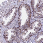 Immunohistochemical staining of human prostate shows moderate membranous-cytoplasmic positivity in glandular cells.