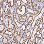 Immunohistochemical staining of human kidney shows moderate membranous-cytoplasmic positivity in cells in tubules.