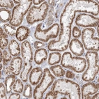 Immunohistochemical staining of human kidney shows strong membranous-cytoplasmic granular positivity in cells in tubules.