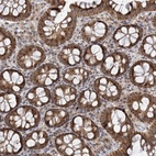 Immunohistochemical staining of human colon shows strong membranous-cytoplasmic granular positivity in glandular cells.