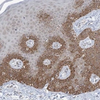 Immunohistochemical staining of human skin shows moderate membranous-cytoplasmic positivity in squamous epithelial cells.
