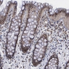 Immunohistochemical staining of human colon shows strong nuclear positivity in glandular cells.