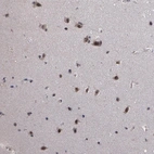 Immunohistochemical staining of human cerebral cortex shows strong nuclear positivity in neuronal cells.