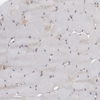 Immunohistochemical staining of human skeletal muscle shows no positivity in myocytes.