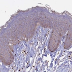 Immunohistochemical staining of human skin shows moderate positivity in cytoplasm granular in squamous epithelial cells.