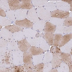 Immunohistochemical staining of human skeletal muscle shows moderate positivity in cytoplasm granular in subset of myocytes.