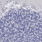 Immunohistochemical staining of human cerebellum shows very weak cytoplasmic positivity in Purkinje cells.