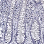 Immunohistochemical staining of human colon shows no positivity in glandular cells.