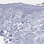Immunohistochemical staining of human skin shows no positivity in squamous epithelial cells.