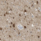 Immunohistochemical staining of human cerebral cortex shows strong cytoplasmic positivity in neuronal cells.