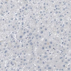 Immunohistochemical staining of human liver shows no cytoplasmic positivity in hepatocytes as expected.