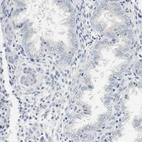 Immunohistochemical staining of human endometrium shows no cytoplasmic positivity in glandular cells as expected.