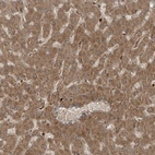 Immunohistochemical staining of human liver shows strong cytoplasmic positivity in hepatocytes.