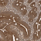 Immunohistochemical staining of human small intestine shows strong cytoplasmic positivity in glandular cells.
