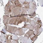 Immunohistochemical staining of human skeletal muscle shows moderate cytoplasmic positivity in myocytes.