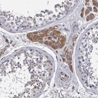 Immunohistochemical staining of human testis shows moderate cytoplasmic positivity in Leydig cells.