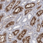 Immunohistochemical staining of human kidney shows strong membranous-cytoplasmic positivity in cells in tubules.