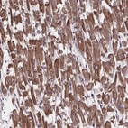 Immunohistochemical staining of human heart muscle shows strong granular cytoplasmic positivity in cardiomyocytes.
