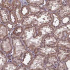 Immunohistochemical staining of human kidney shows strong granular cytoplasmic positivity in cells in tubules.