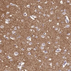 Immunohistochemical staining of human cerebral cortex shows moderate to strong granular cytoplasmic positivity in neuropil.