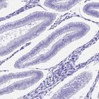 Immunohistochemical staining of human endometrium shows no positivity in glandular cells as expected.