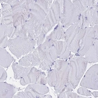 Immunohistochemical staining of human skeletal muscle shows no positivity in myocytes as expected.