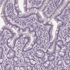 Immunohistochemical staining of human small intestine shows no positivity in glandular cells as expected.