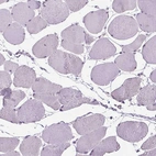 Immunohistochemical staining of human skeletal muscle shows no positivity in myocytes as expected.