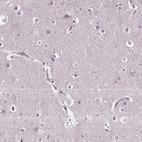 Immunohistochemical staining of human cerebral cortex shows no positivity in neuronal cells as expected.