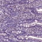 Immunohistochemical staining of human duodenum shows strong nuclear positivity in lymphoid cells.