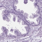 Immunohistochemical staining of human prostate shows no nuclear positivity in glandular cells as expected.