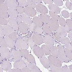 Immunohistochemical staining of human skeletal muscle shows no nuclear positivity in myocytes as expected.