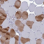 Immunohistochemical staining of human skeletal muscle shows strong cytoplasmic-membranous positivity in subset of myocytes.