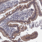 Immunohistochemical staining of human duodenum shows moderate membranous-cytoplasmic positivity in glandular cells.