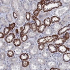 Immunohistochemical staining of human kidney shows strong membranous-cytoplasmic positivity in subset of cells in tubules.