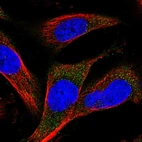 Immunofluorescent staining of human cell line U-251 MG shows localization to vesicles.