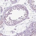 Immunohistochemical staining of human testis shows moderate nuclear-nucleoli positivity in Sertoli cells.