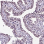 Immunohistochemical staining of human fallopian tube shows moderate nuclear-nucleoli positivity in glandular cells.