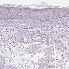 Immunohistochemical staining of human skin shows weak nuclear positivity in squamous epithelial cells.