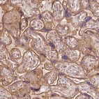 Immunohistochemical staining of human placenta shows moderate membranous-cytoplasmic positivity in trophoblastic cells.