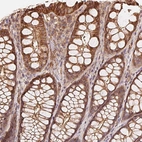 Immunohistochemical staining of human colon shows moderate membranous-cytoplasmic positivity in glandular cells.