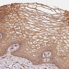 Immunohistochemical staining of human skin shows moderate membranous-cytoplasmic positivity in squamous epithelial cells.