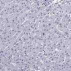 Immunohistochemical staining of human liver shows no positivity in hepatocytes as expected.