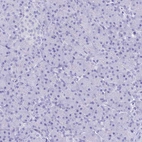 Immunohistochemical staining of human pancreas shows no positivity in exocrine glandular cells as expected.