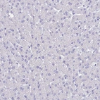 Immunohistochemical staining of human liver shows no positivity in hepatocytes as expected.