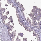 Immunohistochemical staining of human prostate shows moderate apical membrane and cytoplasmic positivity in glandular cells
