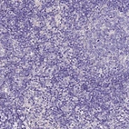 Immunohistochemical staining of human lymph node shows no positivity in non-germinal center cells as expected.