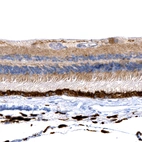 Immunohistochemical staining of human eye retina shows strong positivity in the pigmental cells, as well as moderate positivity in the epithelial cells.